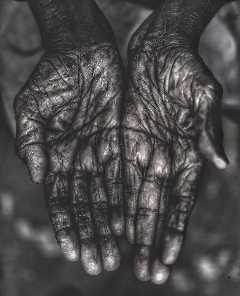 A persons palms with very deep lines